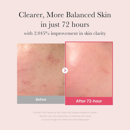 TXA Niacinamide 15 Serum