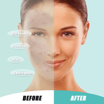 Clean Face Towel
