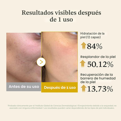 Kojic Acid Turmeric Vita Jelly Mist Serum