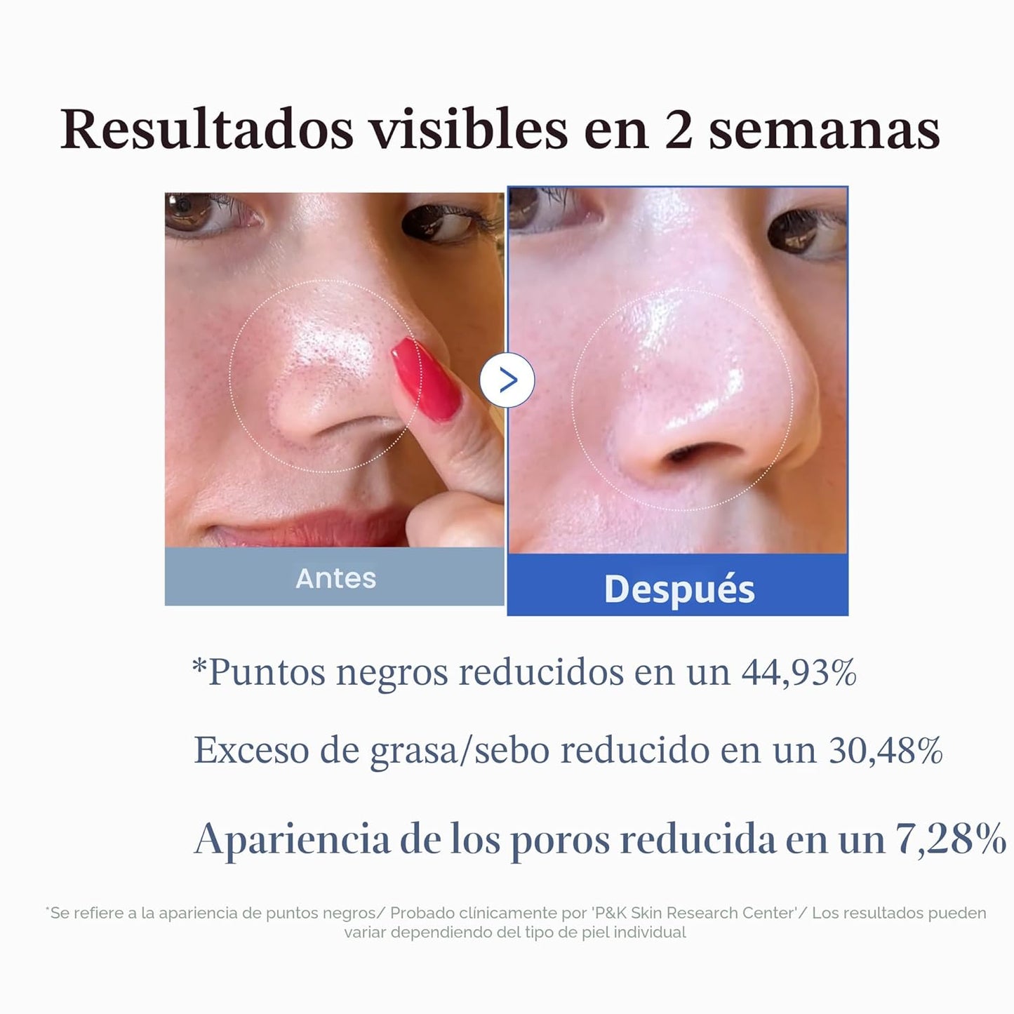 Zero Pore Pads
